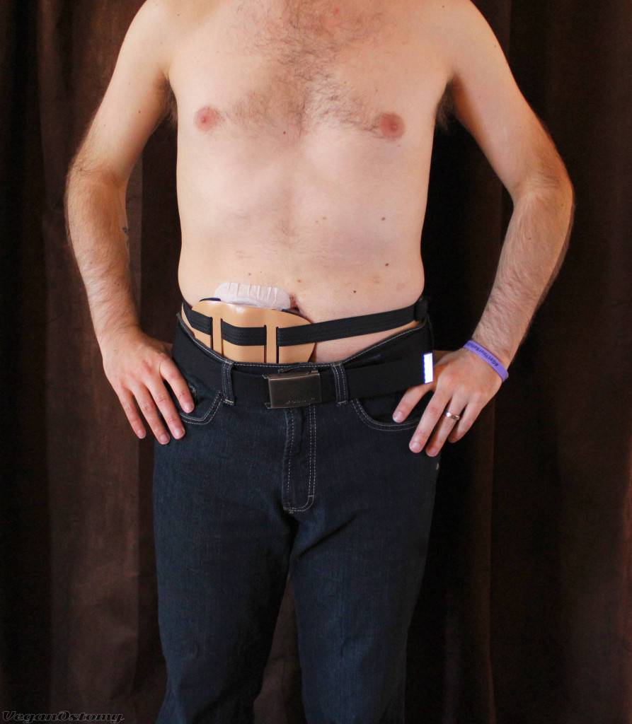 Dressing with an Ostomy: A Clothing Guide for Men, VeganOstomy