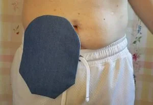 C&S Ostomy Pouch Cover: REVIEW